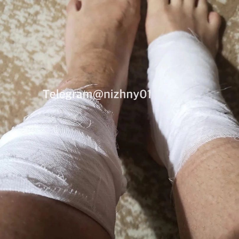 В Выксе собаки напали на девушку